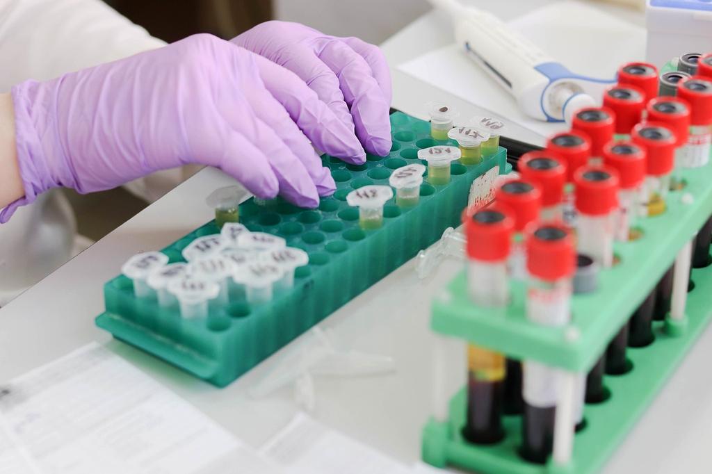 Pharmaceutical quality control with computer vision